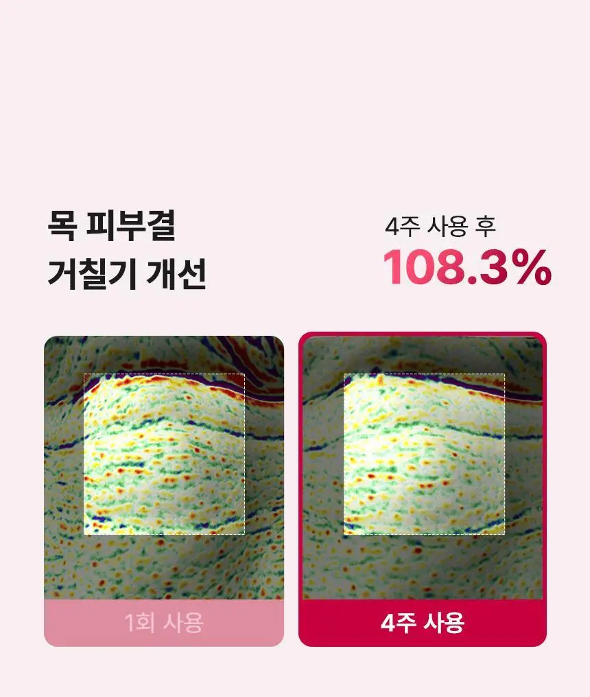 [줄기세포 넥패치/목주름] 뷰앤디 넥실키 마스크 (1매입/5매입) 상세페이지 25